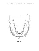 ORAL APPLIANCE FOR TREATMENT OF SNORING AND SLEEP APNEA diagram and image