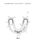 ORAL APPLIANCE FOR TREATMENT OF SNORING AND SLEEP APNEA diagram and image