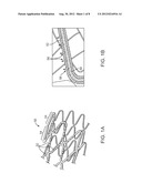 Pressure Chamber And Apparatus For Loading Material Into A Stent Strut diagram and image