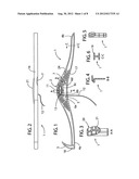 Wound rope or cord support diagram and image