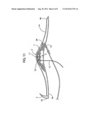 Wound rope or cord support diagram and image