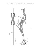 Wound rope or cord support diagram and image