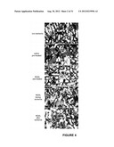 NGAL FOR DIAGNOSIS OF RENAL CONDITIONS diagram and image