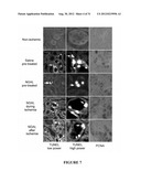 NGAL FOR DIAGNOSIS OF RENAL CONDITIONS diagram and image