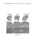 NGAL FOR DIAGNOSIS OF RENAL CONDITIONS diagram and image