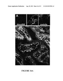 NGAL FOR DIAGNOSIS OF RENAL CONDITIONS diagram and image