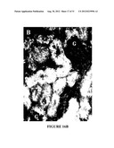 NGAL FOR DIAGNOSIS OF RENAL CONDITIONS diagram and image