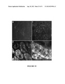 NGAL FOR DIAGNOSIS OF RENAL CONDITIONS diagram and image