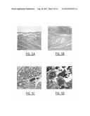 METHOD FOR IDENTIFYING A SUBJECT AT RISK OF DEVELOPING HEART FAILURE BY     DETERMINING THE LEVEL OF GALECTIN-3 OR THROMBOSPONDIN-2 diagram and image