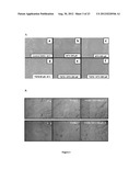 COMPOSTIONS DESIGNED FOR THE INHIBITION AND/OR BLOCKING OF THE     EPITHELIAL/MESENCHYMAL TRANSITION diagram and image