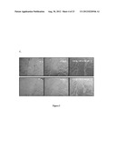 COMPOSTIONS DESIGNED FOR THE INHIBITION AND/OR BLOCKING OF THE     EPITHELIAL/MESENCHYMAL TRANSITION diagram and image