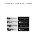 COMPOSTIONS DESIGNED FOR THE INHIBITION AND/OR BLOCKING OF THE     EPITHELIAL/MESENCHYMAL TRANSITION diagram and image