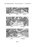 COMPOSTIONS DESIGNED FOR THE INHIBITION AND/OR BLOCKING OF THE     EPITHELIAL/MESENCHYMAL TRANSITION diagram and image