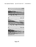 COMPOSTIONS DESIGNED FOR THE INHIBITION AND/OR BLOCKING OF THE     EPITHELIAL/MESENCHYMAL TRANSITION diagram and image