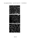 COMPOSTIONS DESIGNED FOR THE INHIBITION AND/OR BLOCKING OF THE     EPITHELIAL/MESENCHYMAL TRANSITION diagram and image