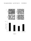 USE OF TWO MICRORNA MOLECULARS IN LUNG CANCER PROGNOSIS AND MEDICINE     PREPARATION diagram and image