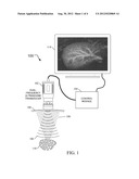 SYSTEMS, METHODS, AND COMPUTER READABLE MEDIA FOR HIGH FREQUENCY CONTRAST     IMAGING AND IMAGE-GUIDED THERAPEUTICS diagram and image