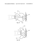 DILATOR AND ASSEMBLY COMPRISING SUCH A DILATOR diagram and image