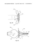 DILATOR AND ASSEMBLY COMPRISING SUCH A DILATOR diagram and image