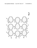 IMPLANT AND METHOD FOR MANUFACTURING SAME diagram and image