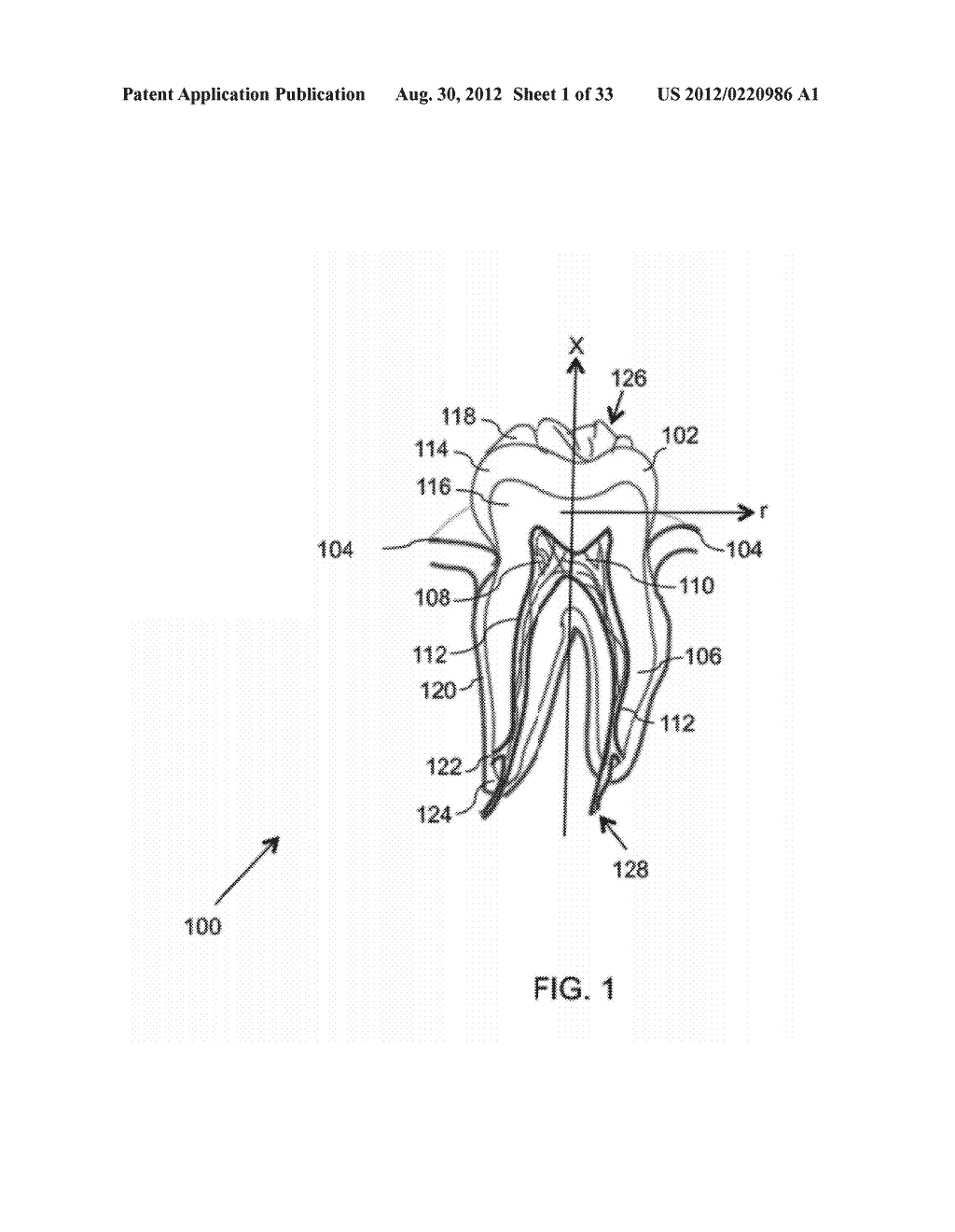 DEVICES AND METHODS FOR INTRAORAL CONTROLLED DRUG RELEASE - diagram, schematic, and image 02