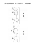 DEVICES AND METHODS FOR INTRAORAL CONTROLLED DRUG RELEASE diagram and image