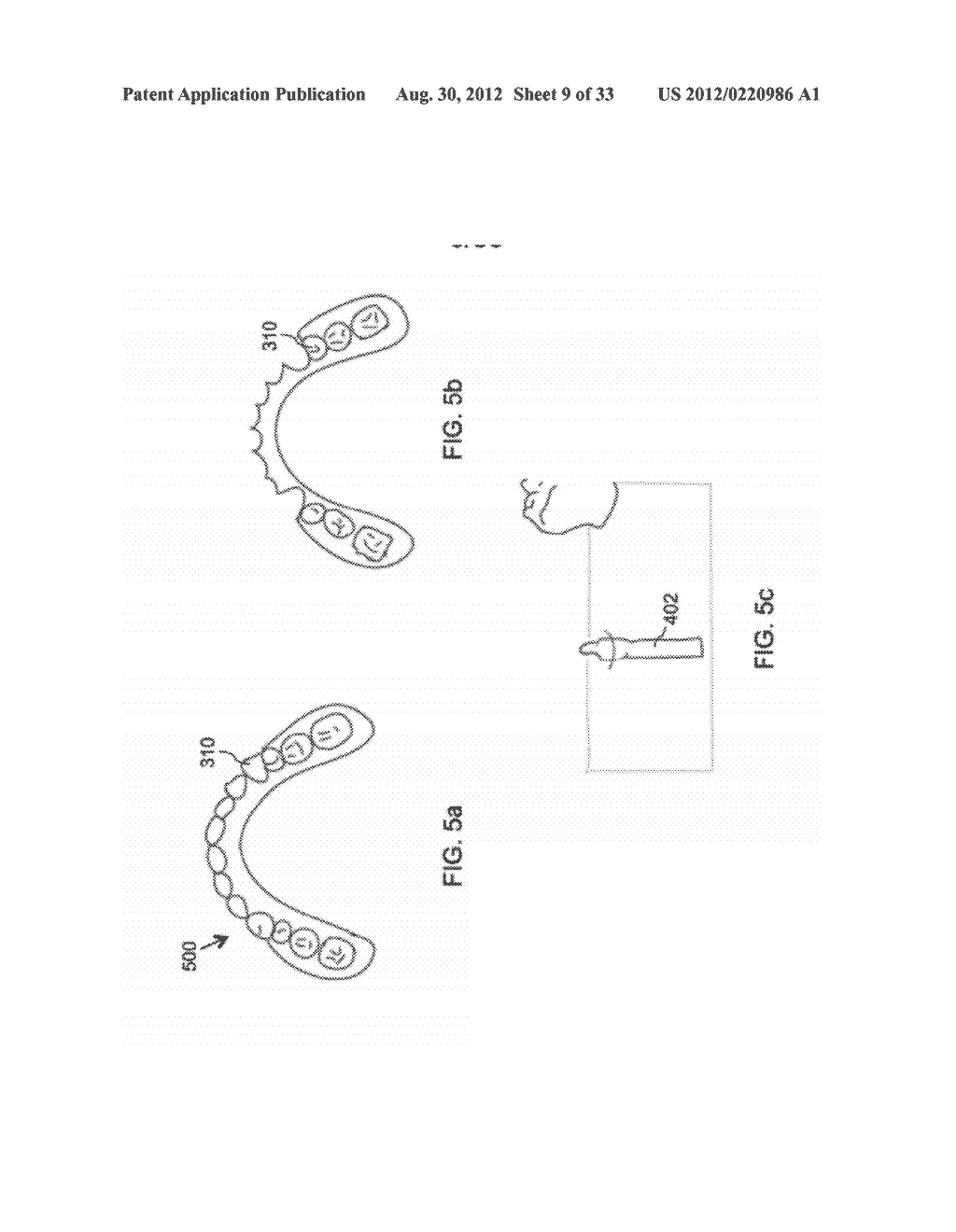 DEVICES AND METHODS FOR INTRAORAL CONTROLLED DRUG RELEASE - diagram, schematic, and image 10