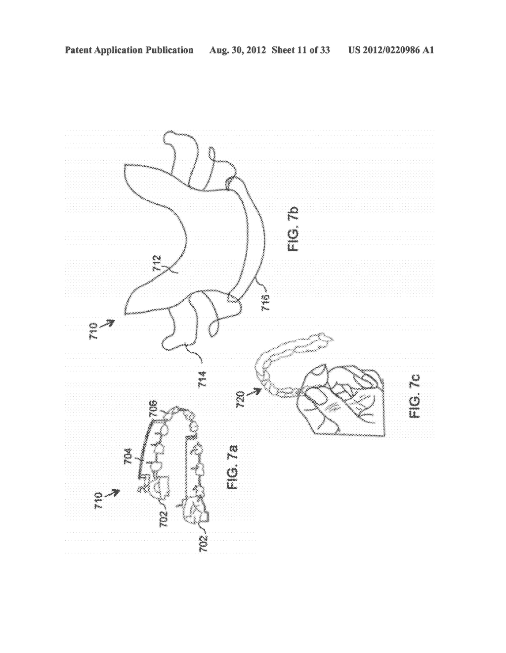 DEVICES AND METHODS FOR INTRAORAL CONTROLLED DRUG RELEASE - diagram, schematic, and image 12