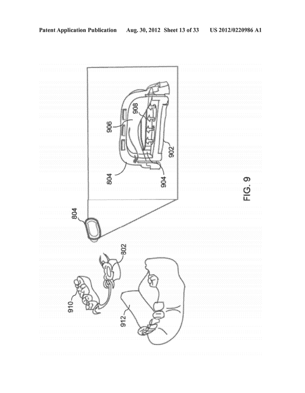 DEVICES AND METHODS FOR INTRAORAL CONTROLLED DRUG RELEASE - diagram, schematic, and image 14