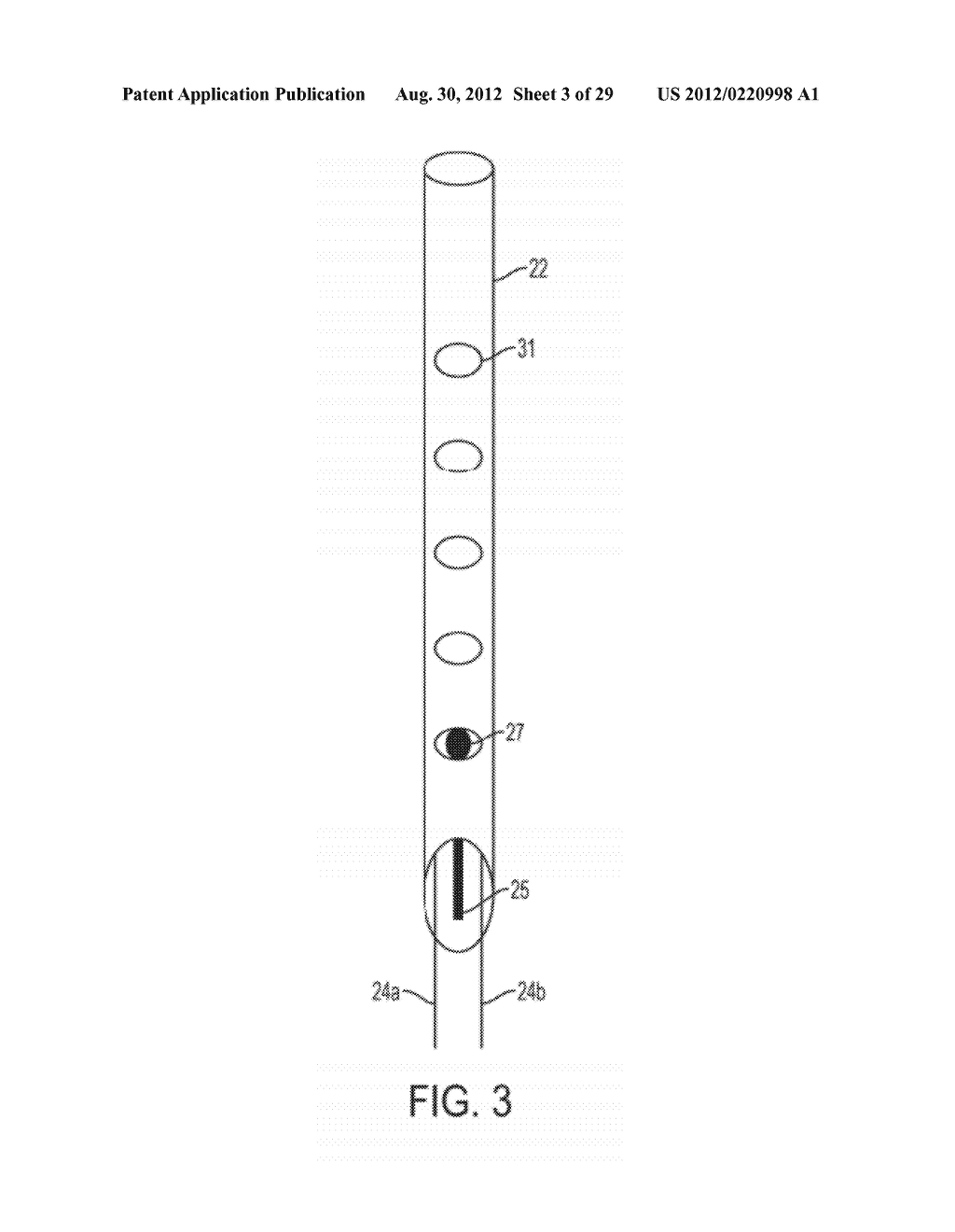 ELECTRICAL ABLATION DEVICES AND METHODS - diagram, schematic, and image 04