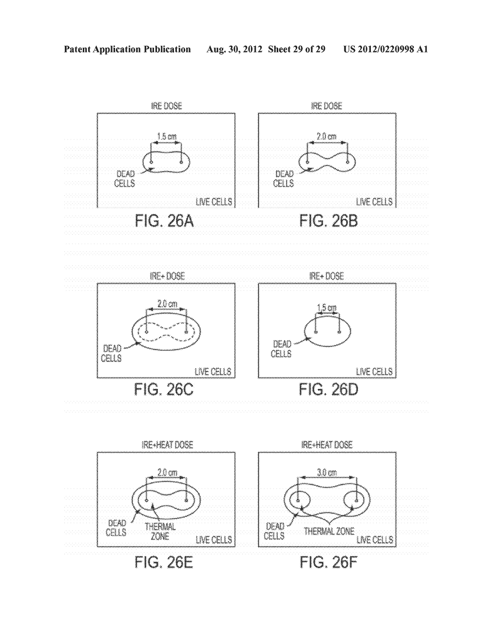 ELECTRICAL ABLATION DEVICES AND METHODS - diagram, schematic, and image 30