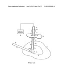 ELECTRICAL ABLATION DEVICES AND METHODS diagram and image