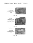 ELECTRICAL ABLATION DEVICES AND METHODS diagram and image