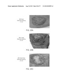 ELECTRICAL ABLATION DEVICES AND METHODS diagram and image