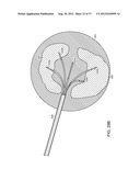 ELECTRICAL ABLATION DEVICES AND METHODS diagram and image