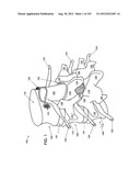 ARTICULATING TISSUE REMOVAL SYSTEMS AND METHODS diagram and image