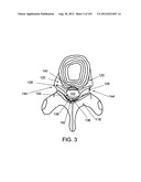 ARTICULATING TISSUE REMOVAL SYSTEMS AND METHODS diagram and image