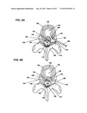 ARTICULATING TISSUE REMOVAL SYSTEMS AND METHODS diagram and image