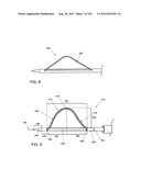 ARTICULATING TISSUE REMOVAL SYSTEMS AND METHODS diagram and image