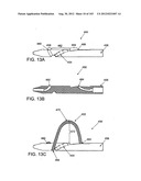 ARTICULATING TISSUE REMOVAL SYSTEMS AND METHODS diagram and image