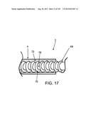 ARTICULATING TISSUE REMOVAL SYSTEMS AND METHODS diagram and image