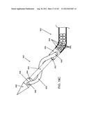 ARTICULATING TISSUE REMOVAL SYSTEMS AND METHODS diagram and image