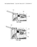 ARTICULATING TISSUE REMOVAL SYSTEMS AND METHODS diagram and image