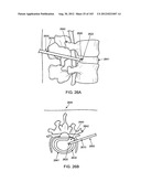 ARTICULATING TISSUE REMOVAL SYSTEMS AND METHODS diagram and image