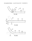 ARTICULATING TISSUE REMOVAL SYSTEMS AND METHODS diagram and image