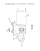 ARTICULATING TISSUE REMOVAL SYSTEMS AND METHODS diagram and image