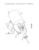 ARTICULATING TISSUE REMOVAL SYSTEMS AND METHODS diagram and image