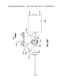 ARTICULATING TISSUE REMOVAL SYSTEMS AND METHODS diagram and image