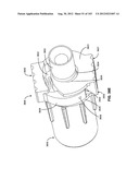 ARTICULATING TISSUE REMOVAL SYSTEMS AND METHODS diagram and image