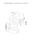 ARTICULATING TISSUE REMOVAL SYSTEMS AND METHODS diagram and image